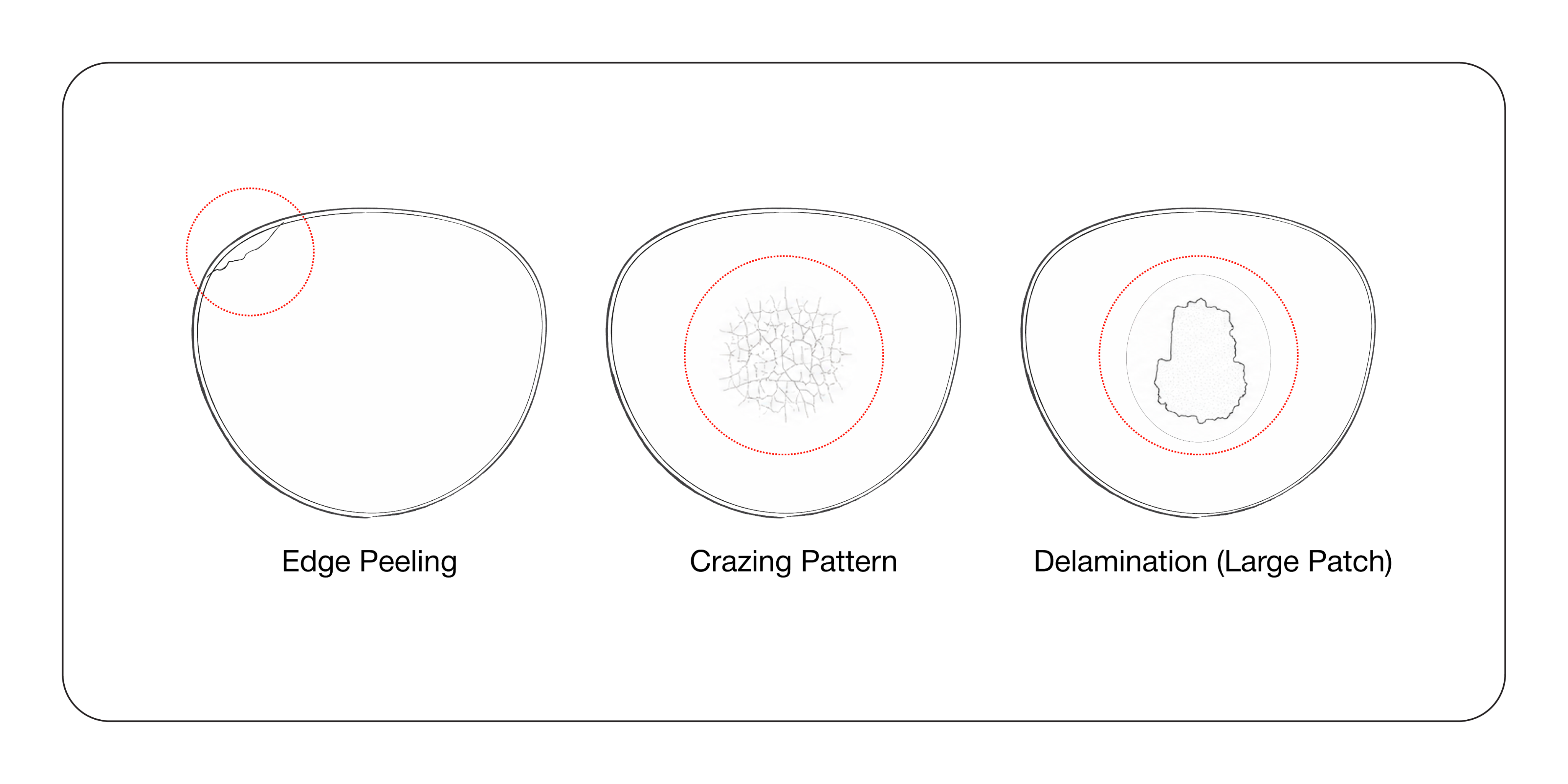 Lens edge peeling, crazing, and delamination examples